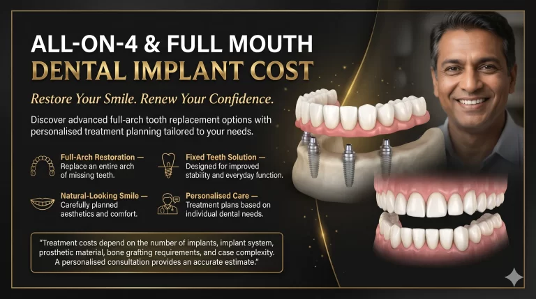 All-on-4 and Full Mouth Dental Implant Cost in Chennai