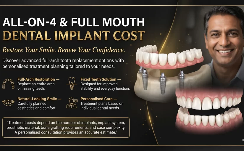 All-on-4 and Full Mouth Dental Implant Cost in Chennai