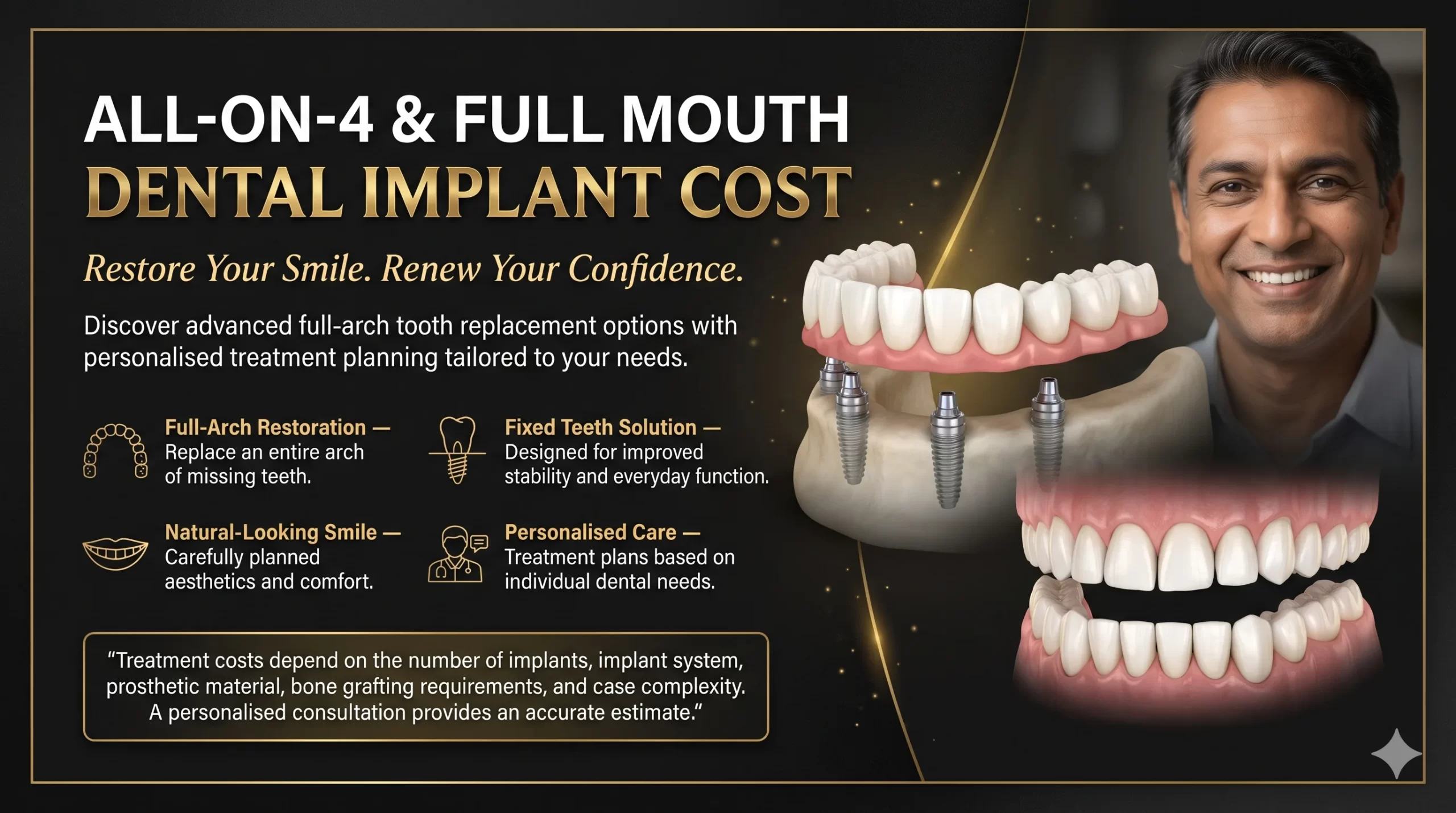 All-on-4 and Full Mouth Dental Implant Cost in Chennai